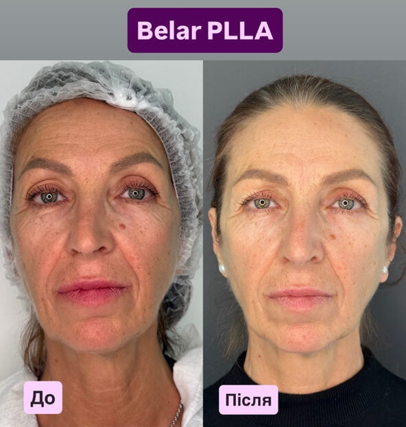 Клінічні кейси Belar