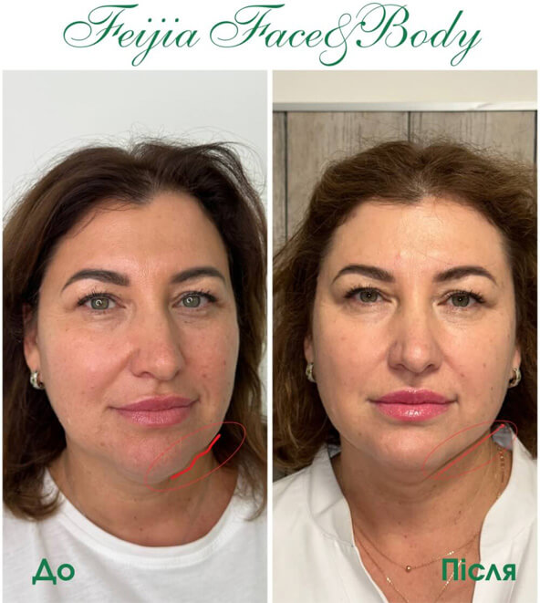 Клінічні кейси колагену Feijia