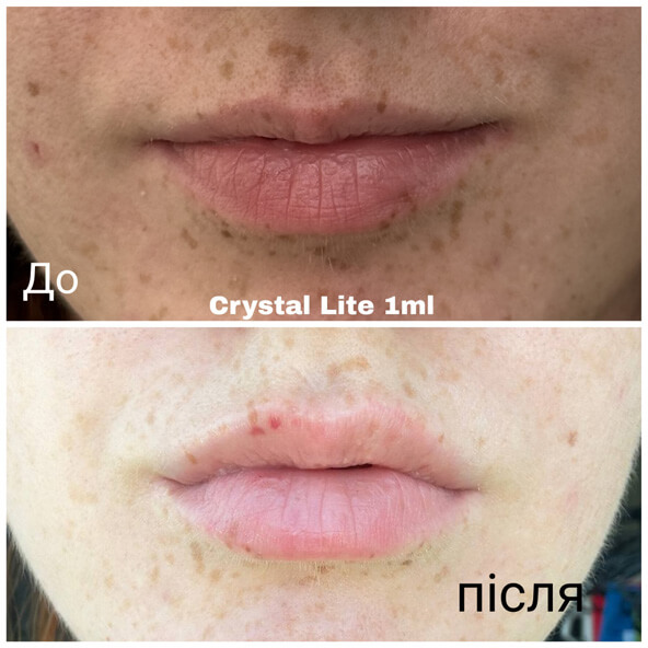 Клінічні кейси Crystal